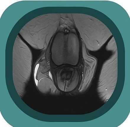 penile mri anatomy icon